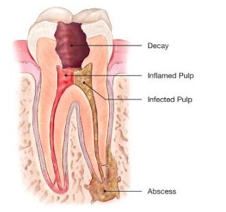 Baby Teeth Chart - Arbo Dental Care - Bradford